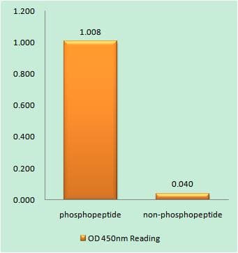 MDM2 Antibody (phospho-Ser186+Ser188)