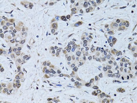 SIN3A Antibody (aa1-120)