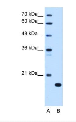 Complement C8b Antibody (aa451-500)