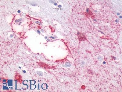 PathPlus™ Polyclonal Rabbit anti-Human GPR87 Antibody (C-Terminus, IHC)