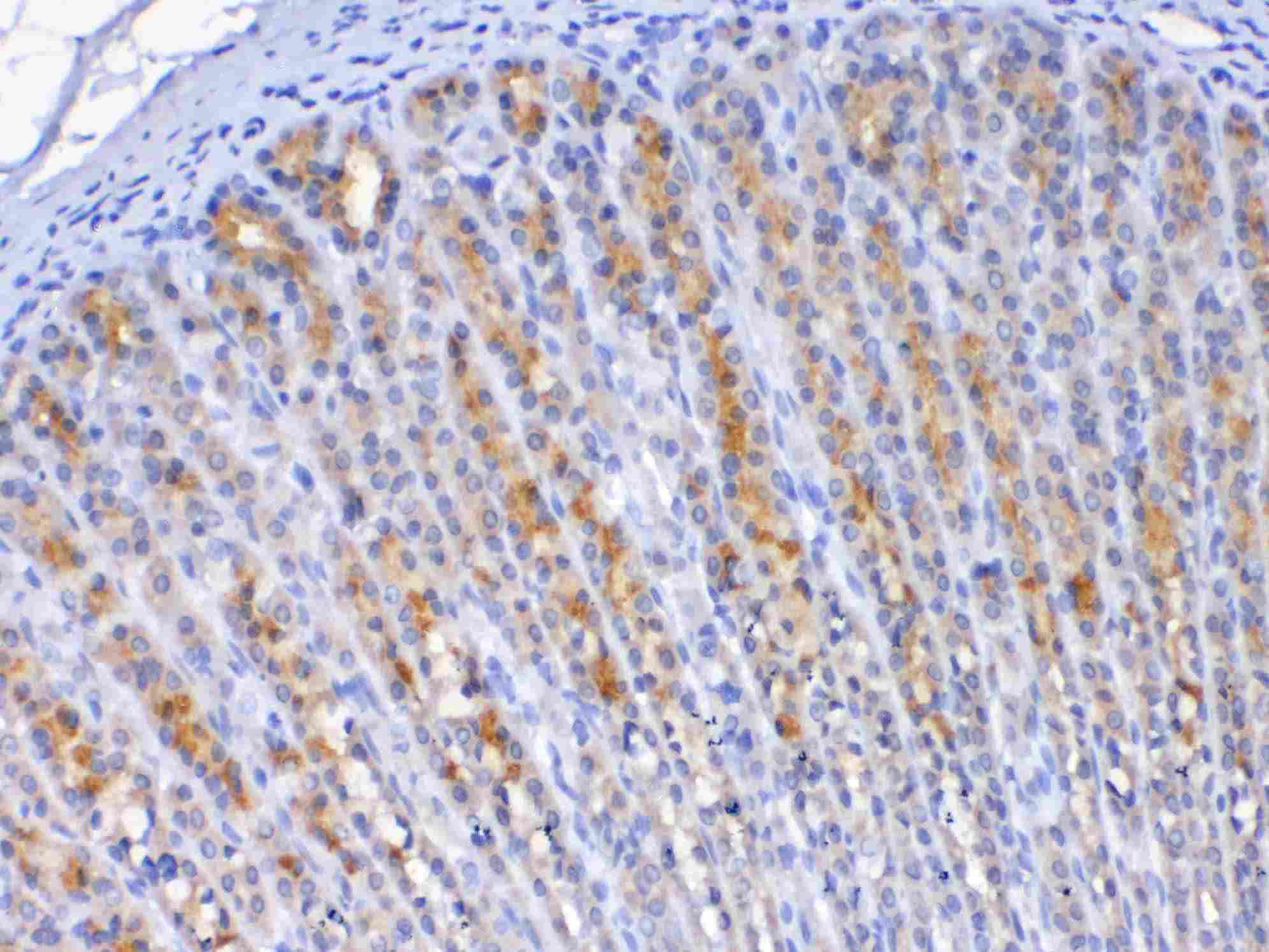 TFF2 / SP Antibody