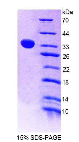 Human THYN1 / HSPC144 Protein (Recombinant His-T7)