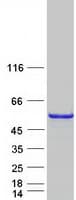 Human CDC123 Protein (Recombinant Myc-DDK (Flag))
