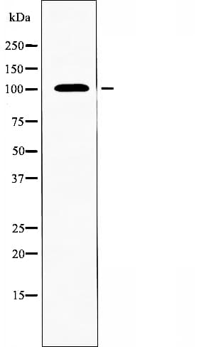 Polyclonal Rabbit anti-Human SLC4A11 / NABC1 Antibody (IF, WB)