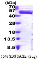 Human MAPK3 / ERK1 Protein (Recombinant His)