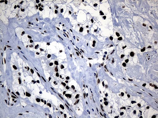 POLR2A / RNA polymerase II Antibody (aa1351-1614, clone OTI2B7)
