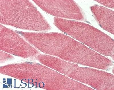 IHC-plus™ ARPC5 / p16-Arc Antibody (clone 2G1)
