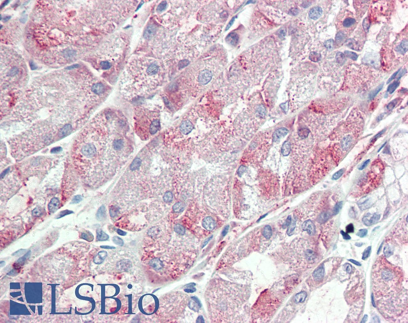 IHC-plus™ ITGA6/Integrin Alpha 6/CD49f Antibody (Internal)