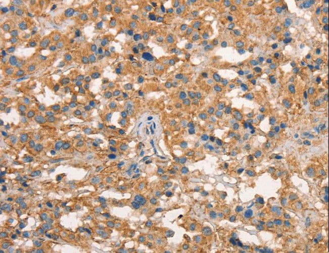 Polyclonal Rabbit anti-Human ART4 Antibody (IHC, WB)