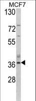 ASPA Antibody (aa82-110)