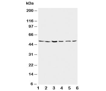 PSEN2 / Presenilin 2 Antibody (aa39-51)