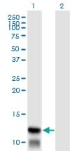 TIMM8A Antibody (clone 2F11)