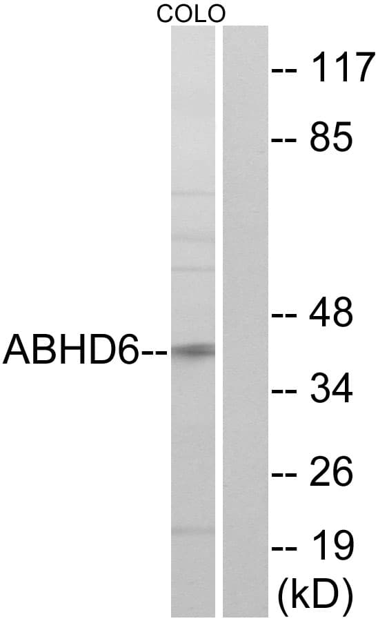 IHC-plus™ ABHD6 Antibody (aa231-280)