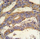 RSAD1 Antibody (aa299-328)