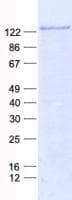 Human CDH20 / Cadherin 20 Protein (Recombinant His, N-Terminal)