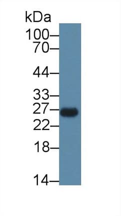 C/EBP Delta / CEBPD Antibody
