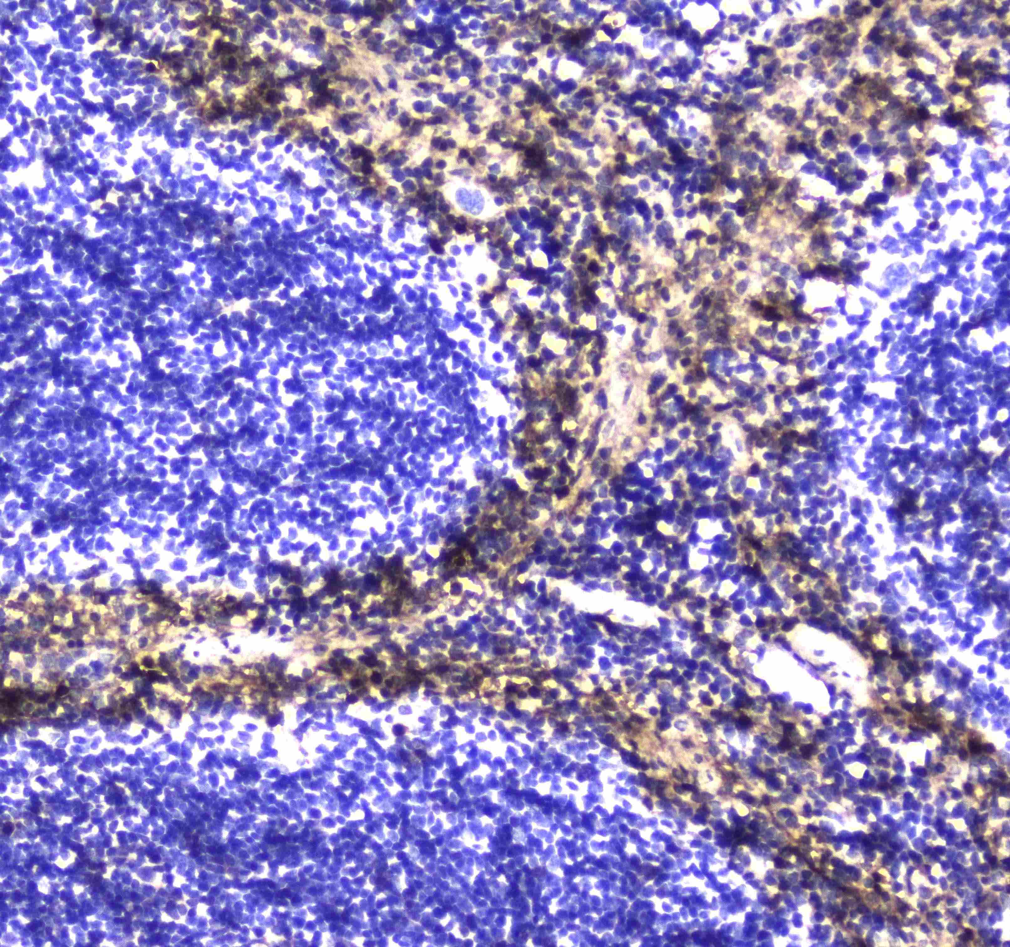 S100A10 Antibody