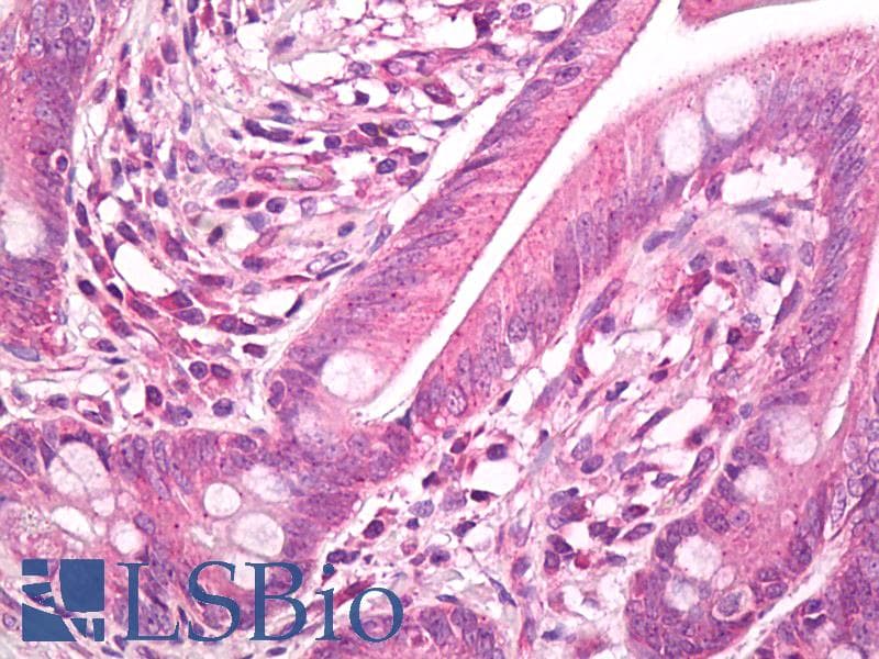 IHC-plus™ Polyclonal Rabbit anti-Human HSPB1 / HSP27 Antibody (aa50-100, IHC, WB)