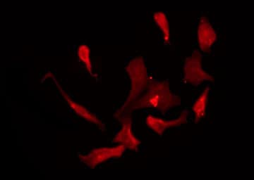 KCND1 / Kv4.1 Antibody