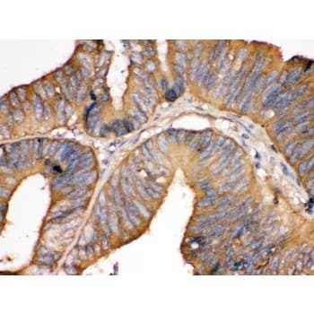 TF / Transferrin Antibody (aa20-49)