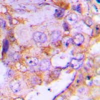 Polyclonal Rabbit anti-Human EIF4EBP1 / 4EBP1 Antibody (N-Terminus, IHC, IF, WB)