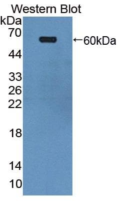 EPHA4 / EPH Receptor A4 Antibody (aa621-882, Biotin)