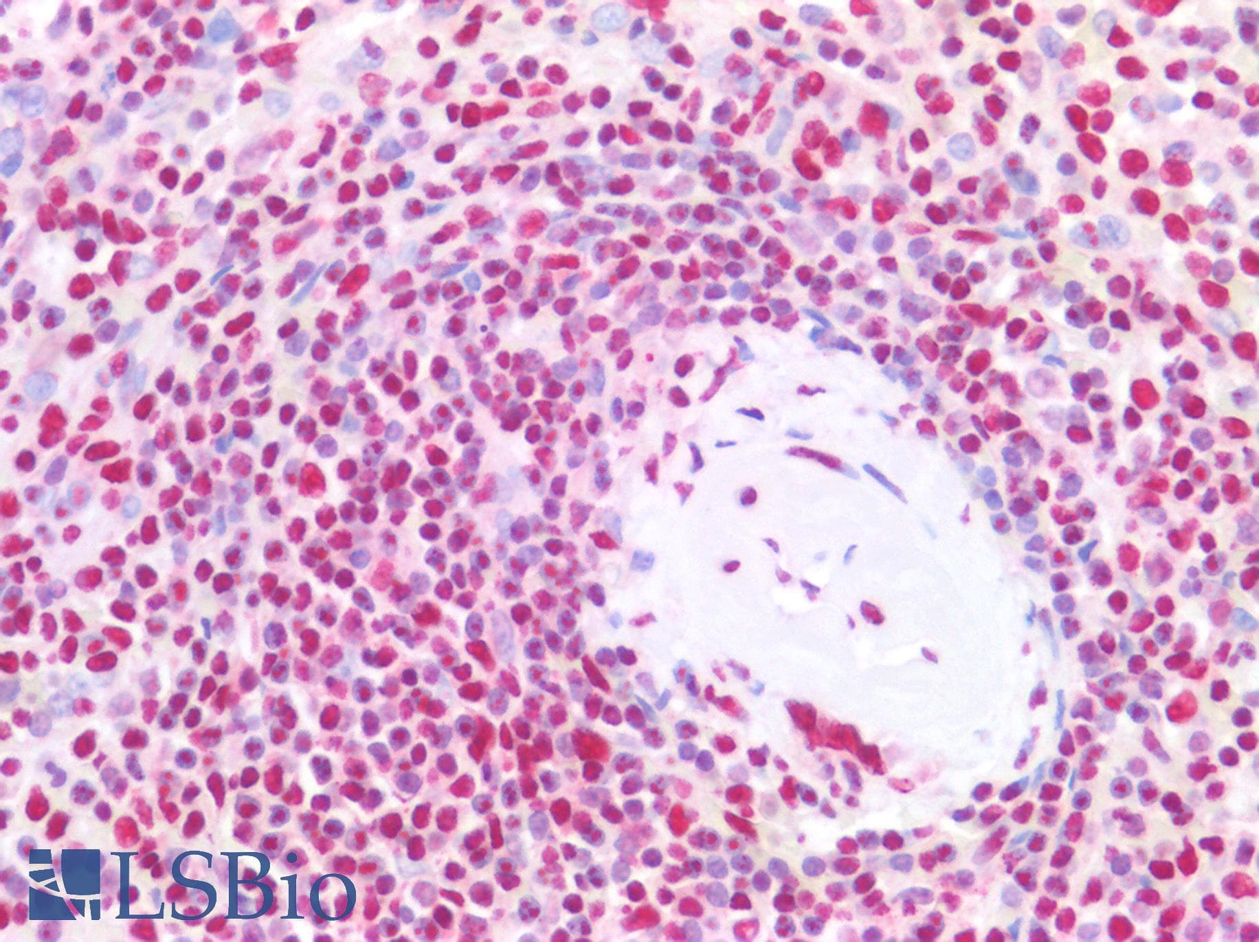 IHC-plus™ Monoclonal Mouse anti-Human PTBP3 / ROD1 Antibody (clone OTI5C9, aa300-552, IHC, WB)