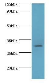 HSD11B1 / HSD11B Antibody (aa25-292, FITC)