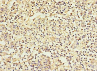WFDC11 Antibody