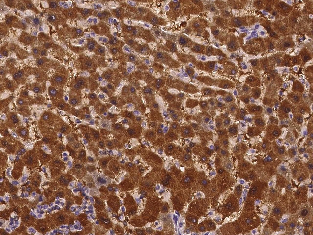 AMDHD1 Antibody