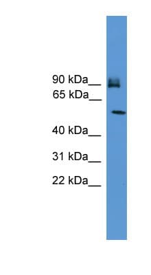 Polyclonal Rabbit anti-Human OSBPL11 Antibody (aa651-700, WB)