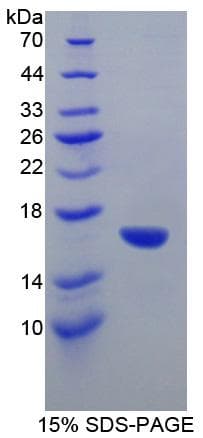Mouse GAD1 / GAD67 Protein (Recombinant His-S)