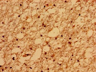 Polyclonal Rabbit anti-Human TMEM67 Antibody