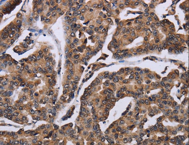 Polyclonal Rabbit anti-Human KIF1C Antibody (IHC, WB)