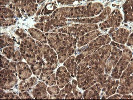 STK38L / NDR2 Antibody (clone OTI4D8)