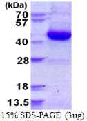 Human GNAI3 Protein (Recombinant His)