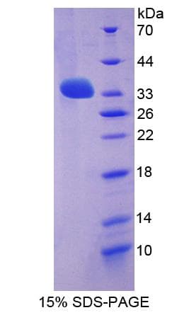 Human LGI3 Protein (Recombinant His-S)
