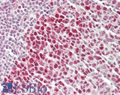 IHC-plus™ Polyclonal Rabbit anti-Human RBBP7 / RbAp46 Antibody (aa375-C-term, IHC, WB)