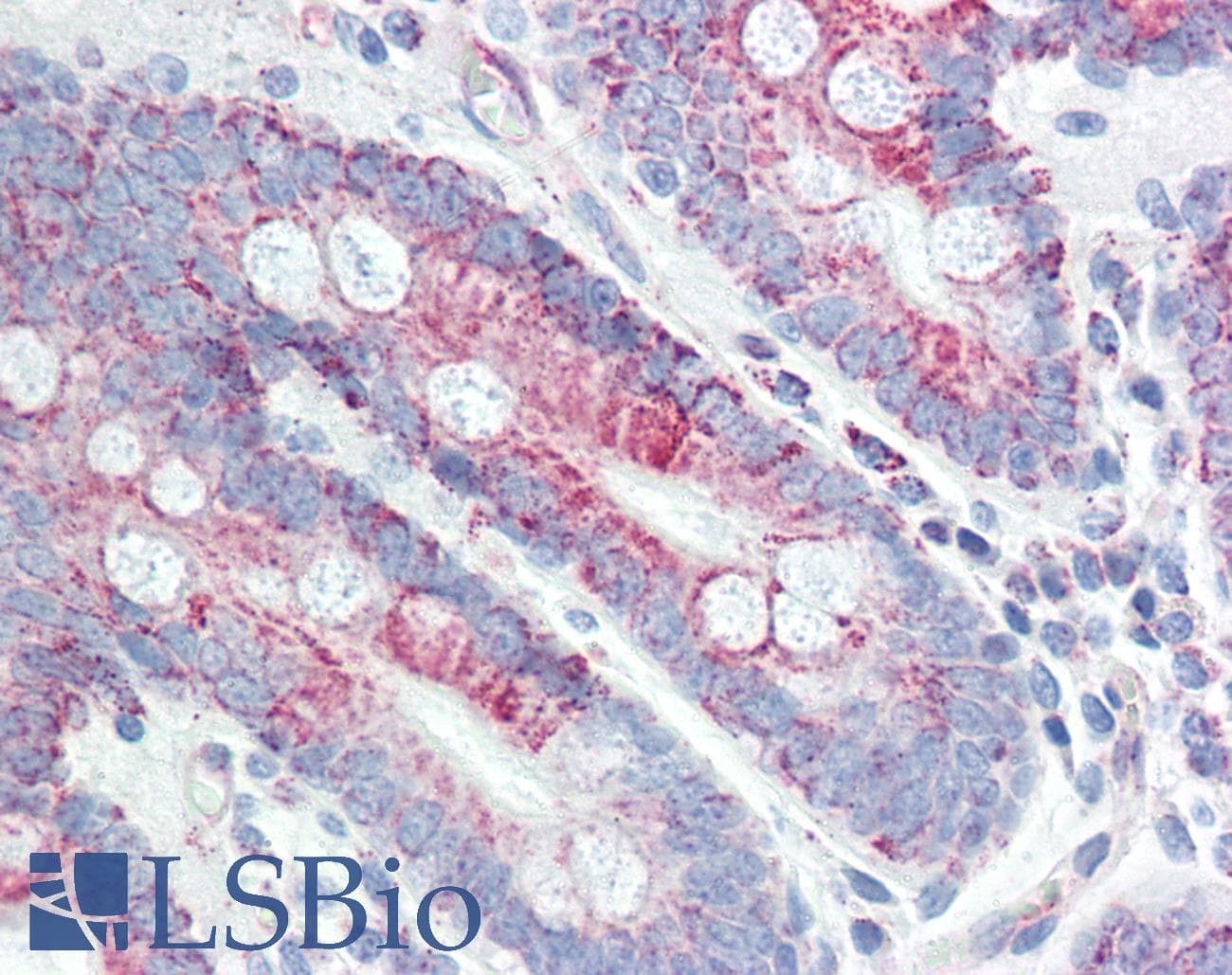 IHC-plus™ Polyclonal Rabbit anti-Human IL13RA1 / IL13R Alpha 1 Antibody (Lys401, IHC, IF, WB)