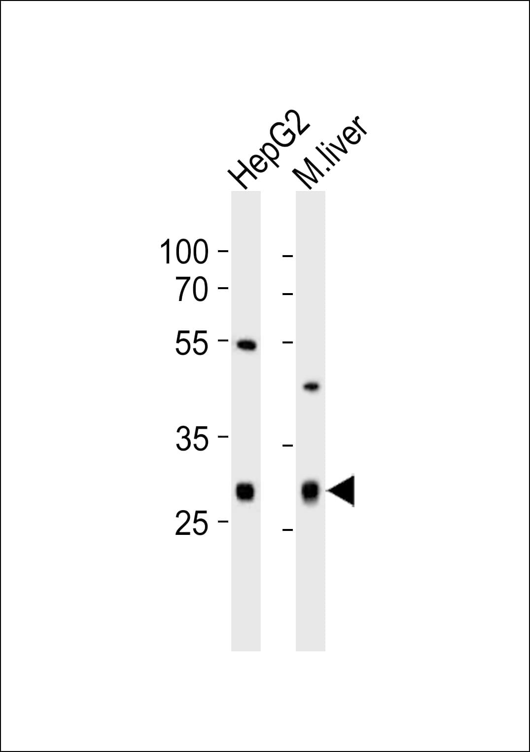 CTDSP1 / SCP1 Antibody (aa16-50)