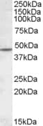 IHC-plus™ CHRNB2 Antibody (aa351-362)