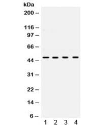 Polyclonal Rabbit anti-Human UBE2Q2 Antibody (IHC, WB)