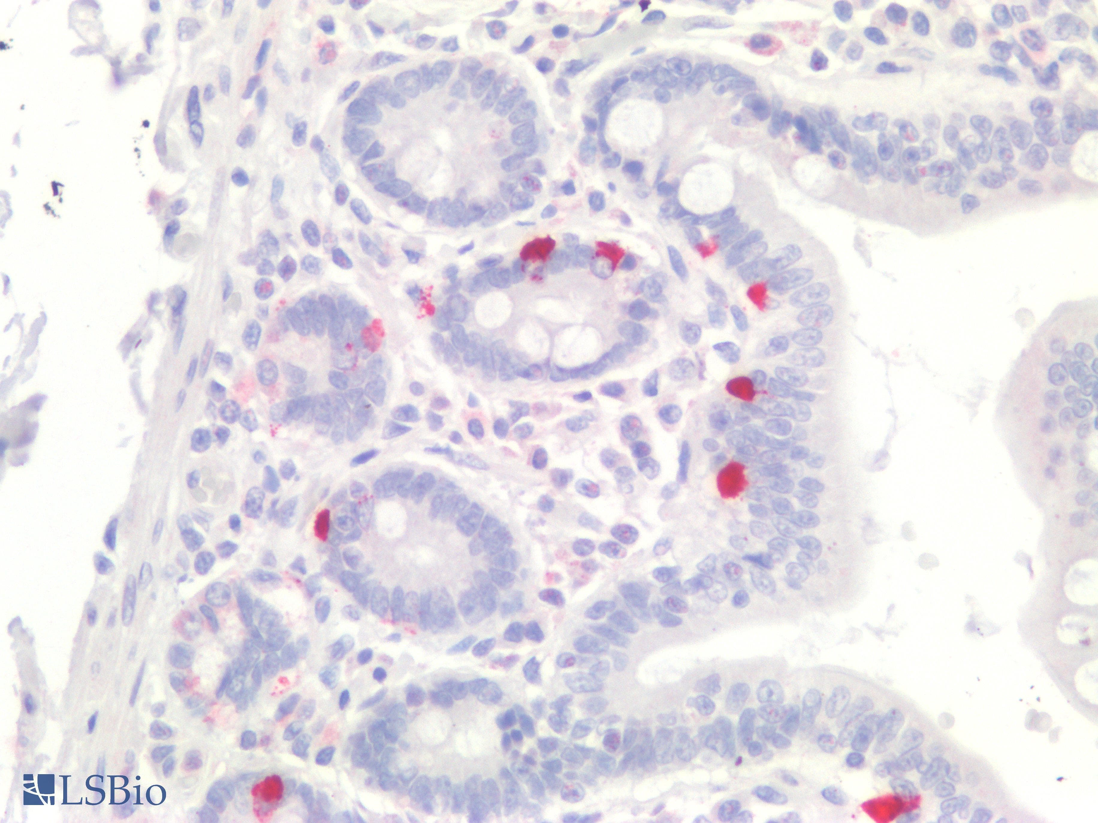 PathPlus™ Polyclonal Rabbit anti-Human CHGA / Chromogranin A Antibody (IHC)