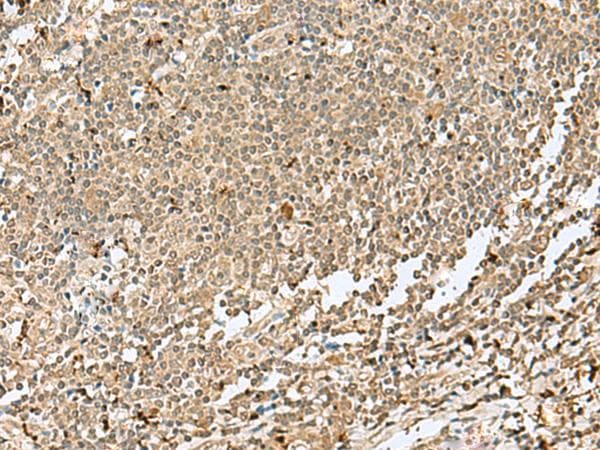 Polyclonal Rabbit anti-Human SNAPC1 Antibody (IHC)