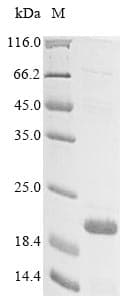 Human TMEM132A / HSPA5BP1 Protein (Recombinant 10His, N-terminus + Myc, C-terminus)