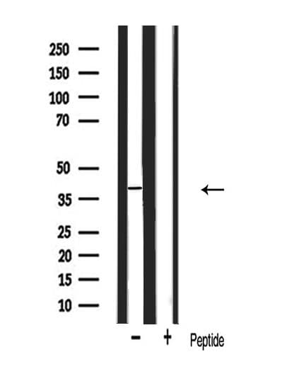 MIP / AQP0 / Aquaporin 0 Antibody