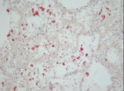 CD163 Antibody (clone 5C6-FAT)