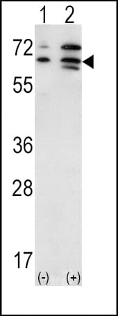 PathPlus™ Polyclonal Rabbit anti-Human ACVR2 / ACVR2A Antibody (aa2-29, IHC, WB)