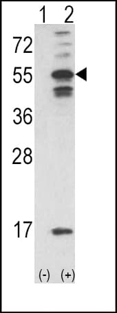 CAMK2A / CaMKII Alpha Antibody (aa344-371)
