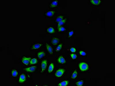 Polyclonal Rabbit anti-Human PEMT Antibody (IF, WB)